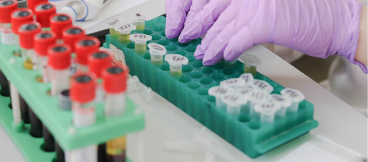 Yalova Eğitim ve Araştırma Hastanesi’nde İlk Kez Hematoloji Uzmanı Göreve Başladı